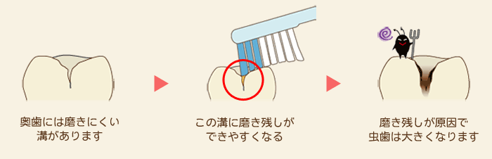 シーラント
