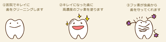 フッ素塗布